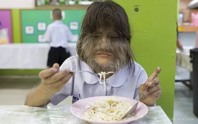 Những trường hợp tái sinh với dấu vết rõ ràng trên cơ thể là bằng chứng của quy luật Nghiệp